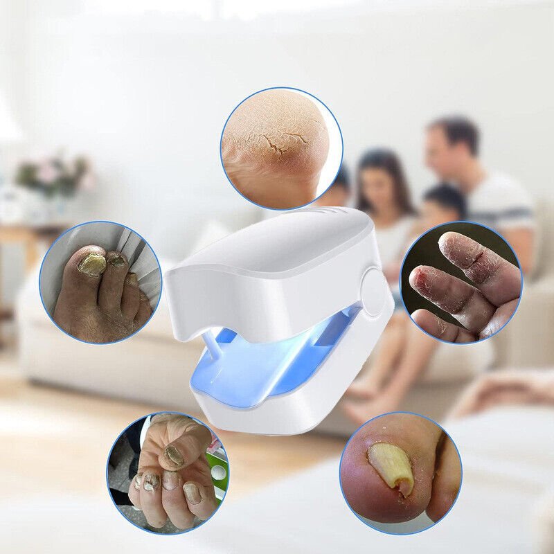 Stornfield | Laser Device for Nail Fungus Removal – Expert's Highly Effective Revolutionary Light Therapy Device for Toenail Problems