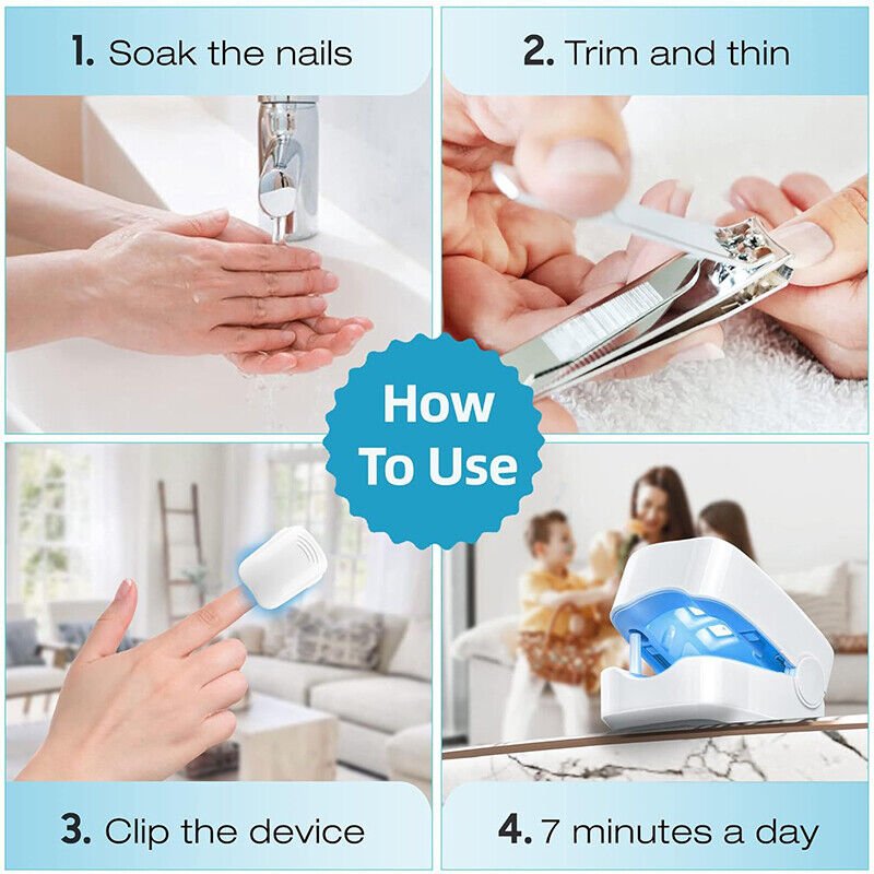 Stornfield | Laser Device for Nail Fungus Removal – Expert's Highly Effective Revolutionary Light Therapy Device for Toenail Problems