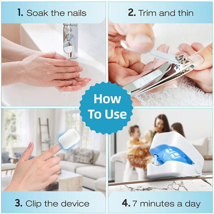Stornfield | Laser Device for Nail Fungus Removal – Expert's Highly Effective Revolutionary Light Therapy Device for Toenail Problems
