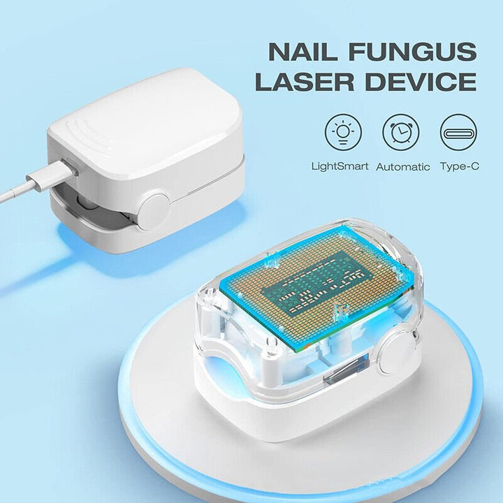 Stornfield | Laser Device for Nail Fungus Removal – Expert's Highly Effective Revolutionary Light Therapy Device for Toenail Problems