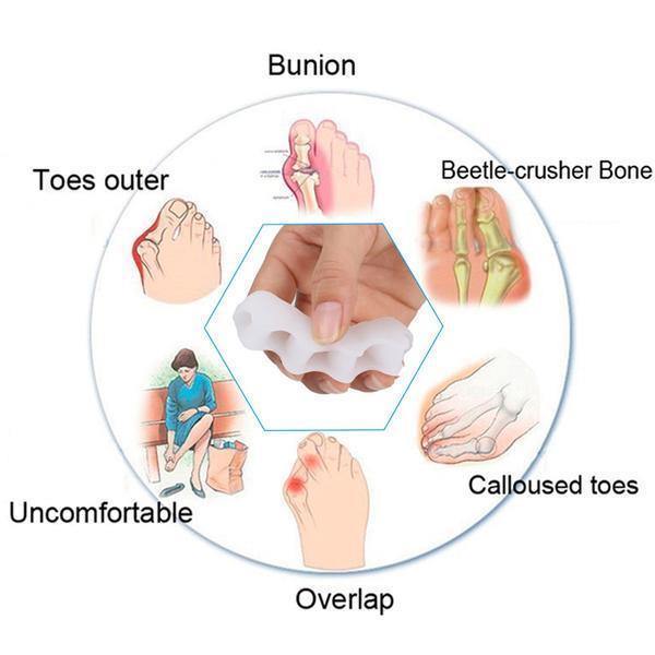 Stornfield | Toe Recovery | Orthopedic Hallux and Hammer Toe Corrector with Toe Separator