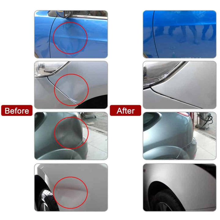 DentXpert Repair your dents easily | Stornfield