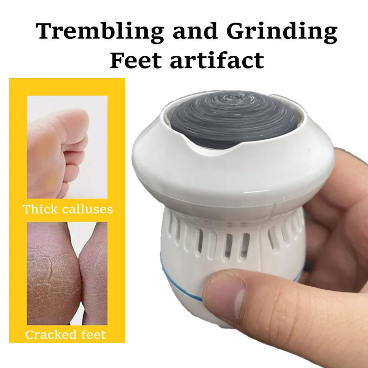 Stornfield | Vacuum callus remover