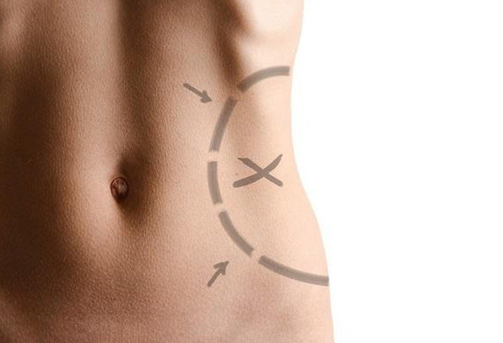 Ultrasound Slimming Device for Home Use | Stornfield